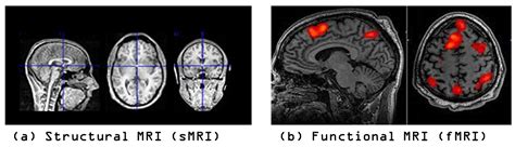 https santafe.craigslist.org pho d metal-boxes-of-original-mm 6168134567.html|SMRI Group Discussion.